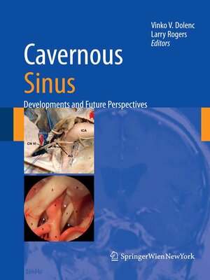 cover image of Cavernous Sinus